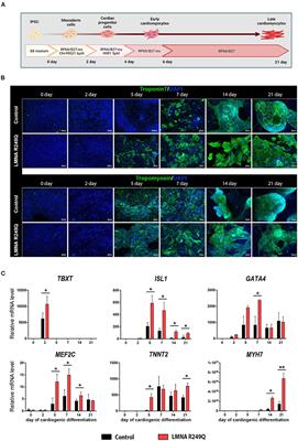 LMNA mutation leads to cardiac sodium channel dysfunction in the Emery-Dreifuss muscular dystrophy patient